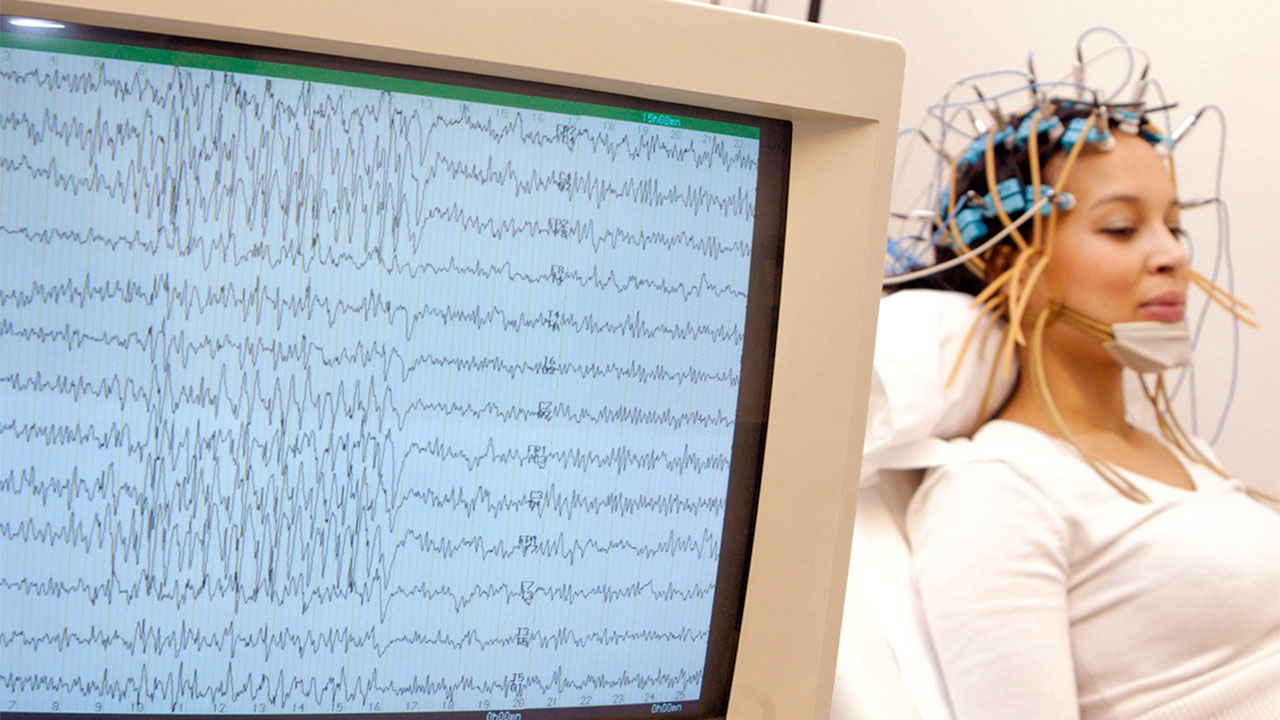 Major Depresif Bozukluk Riskinin EEG ile Belirlenmesi