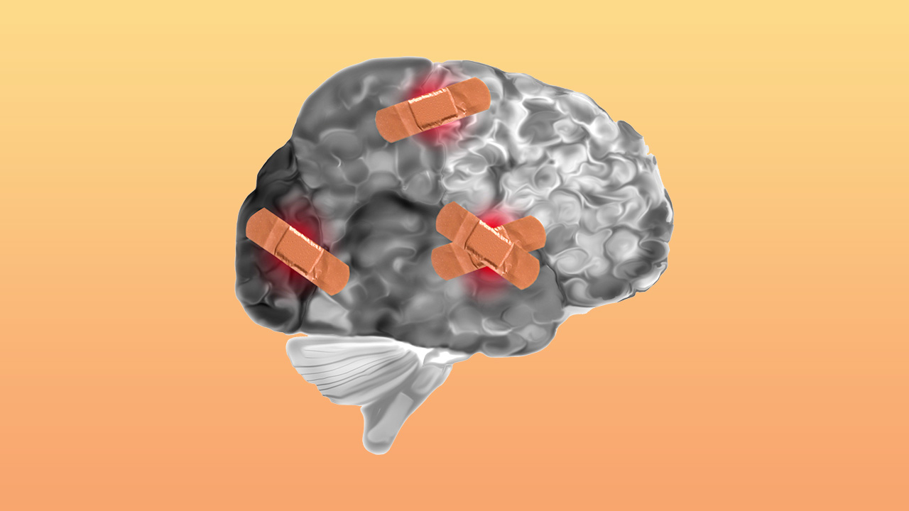 Hafif Travmatik Beyin Hasarı ve Travma Sonrası Stres Bozukluğu Olan Kişilerde Serum Nörosteroid Düzeylerinin Kortikal Kalınlık ile İlişkisi