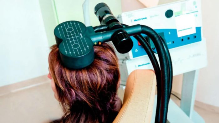 Depresyon tedavisinde idame TMS protokolleri