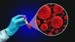 Major depresif bozuklukta antidepresan yanıtının öngörülmesinde periferik kan transkriptomik biyobelirteçleri